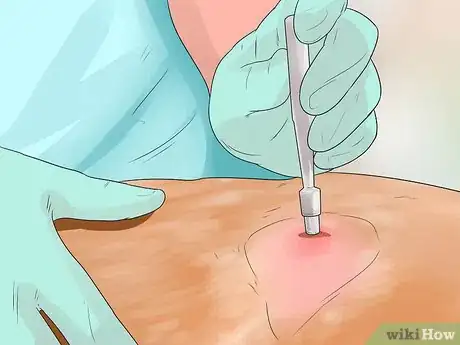Imagen titulada Treat Mast Cell Tumors in Boxers Step 9