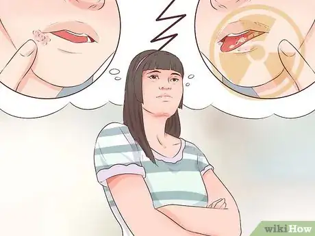 Imagen titulada Tell if You Have a Cold Sore Step 9