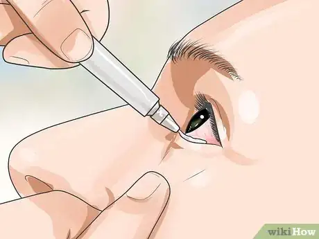 Imagen titulada Recover from Eye Surgery Step 15