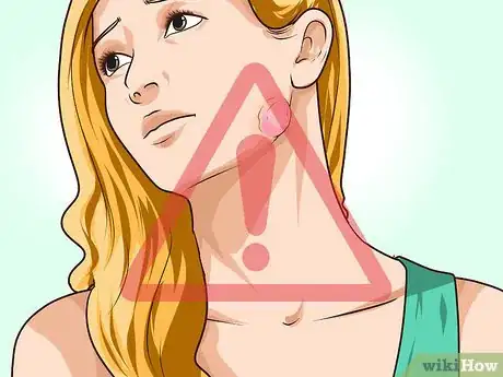 Imagen titulada Prevent Actinomycosis Step 5