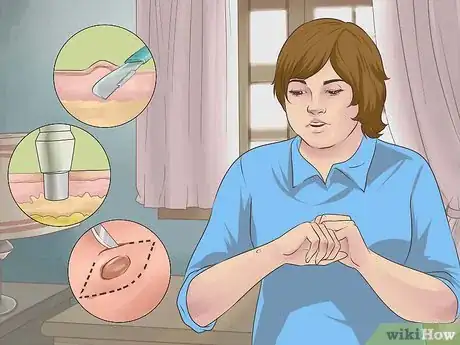 Imagen titulada Heal from a Skin Biopsy Step 1