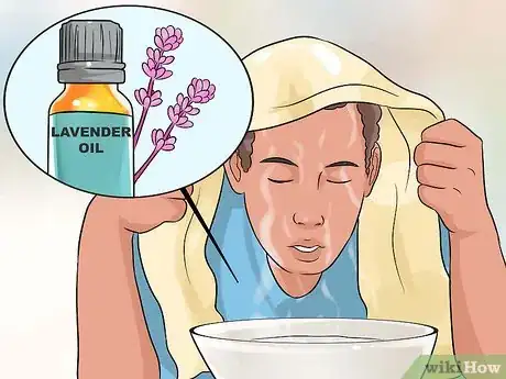 Imagen titulada Cure a Headache Without Medication Step 2