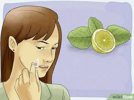 Imagen titulada Get Rid of a Cold Sore with Home Remedies Step 5