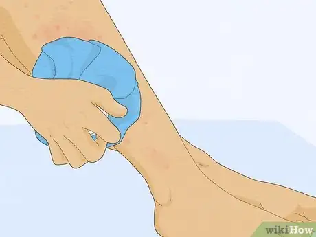Imagen titulada Treat a Face Rash After Waxing Step 2
