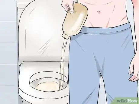 Imagen titulada Change a Colostomy Bag Step 1