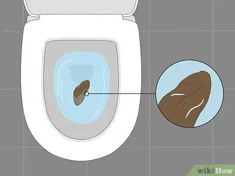 Imagen titulada Know If You Have Worms Step 7
