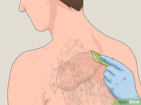 Imagen titulada Get Rid of Back Hair Step 16