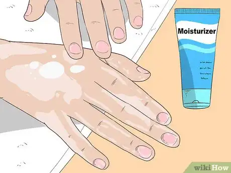 Imagen titulada Get Rid of Psoriasis on Your Nails Step 13