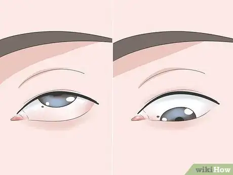 Imagen titulada Get Sand Out of Your Eyes Step 8
