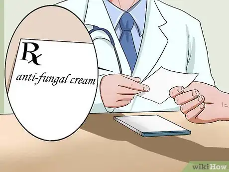 Imagen titulada Treat Ringworm Step 15