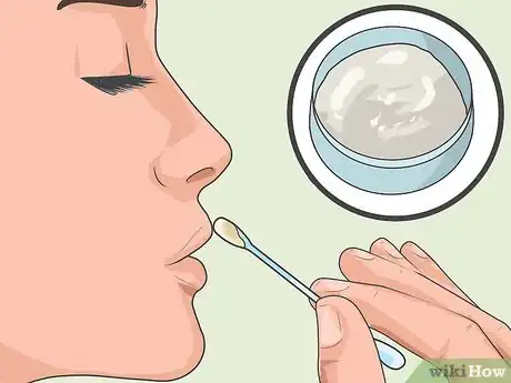 Imagen titulada Heal a Cold Sore Naturally Step 18