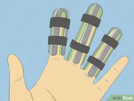 Imagen titulada Get Rid of Arthritis Bumps on Fingers Step 6