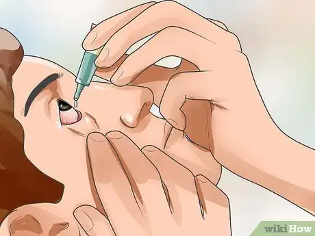 Imagen titulada Recover from Eye Surgery Step 14