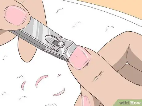 Imagen titulada Get Rid of Psoriasis on Your Nails Step 10
