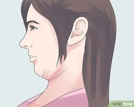 Imagen titulada Treat Headaches at the Base of the Skull (Cervicogenic Headaches) Step 9