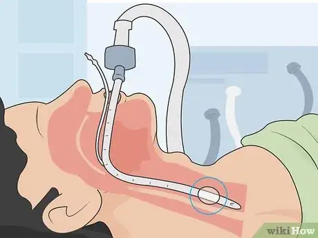 Imagen titulada Measure an ET Tube Step 10