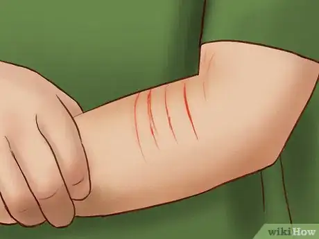 Imagen titulada Deal With a Cat Scratch Step 3