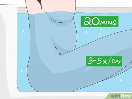 Imagen titulada Prevent Perianal Abscess from Returning Step 9
