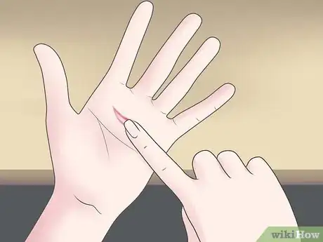 Imagen titulada Treat a Deep Scrape Step 9
