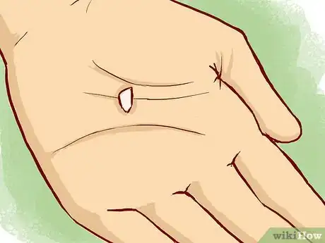 Imagen titulada Treat a Broken Tooth Step 6