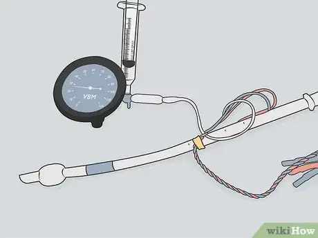 Imagen titulada Measure an ET Tube Step 14
