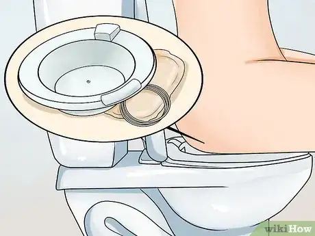 Imagen titulada Cure Hemorrhoids or Piles Step 2