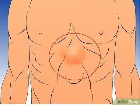 Imagen titulada Check for a Hernia Step 4Bullet2