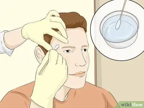 Imagen titulada Treat Idiopathic Guttate Hypomelanosis Step 5