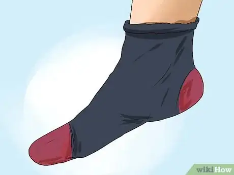 Imagen titulada Care for a Burst Blister Step 14