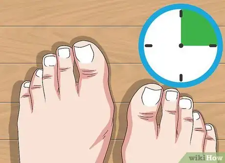 Imagen titulada Do a Self Pedicure Step 17