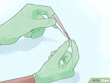 Imagen titulada Insert Boric Acid Suppositories Step 12