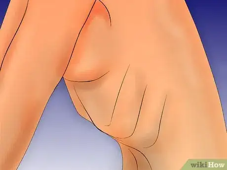 Imagen titulada Check for a Hernia Step 6Bullet4
