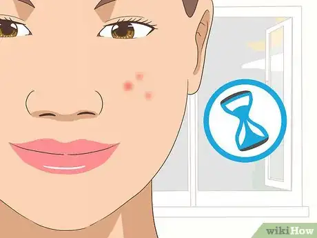 Imagen titulada Use Tea Tree Oil for Acne Step 6