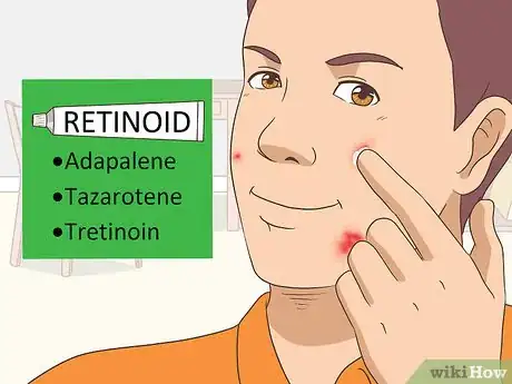 Imagen titulada Get Rid of Acne Cysts Fast Step 4
