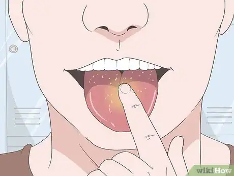 Imagen titulada Heal Your Tongue After Eating Sour Candy Step 1