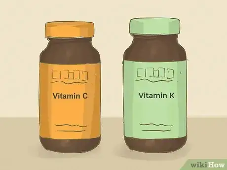 Imagen titulada Remove a Hickey Step 5