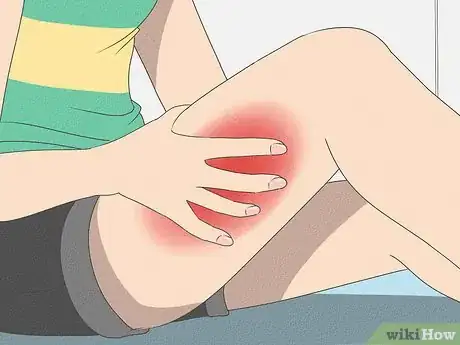Imagen titulada Heal a Pulled Trapezius Muscle Step 3