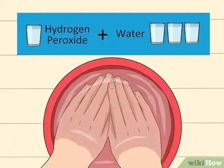 Imagen titulada Get a Bad Smell off Your Hands Step 10