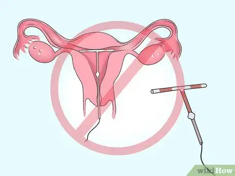 Imagen titulada Prevent Actinomycosis Step 4