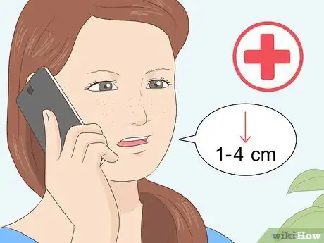 Imagen titulada Measure Fundal Height Step 15
