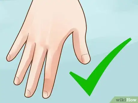 Imagen titulada Prevent Frostbite Step 29