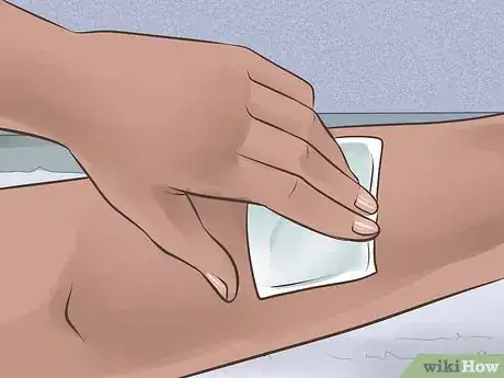 Imagen titulada Heal from a Skin Biopsy Step 2