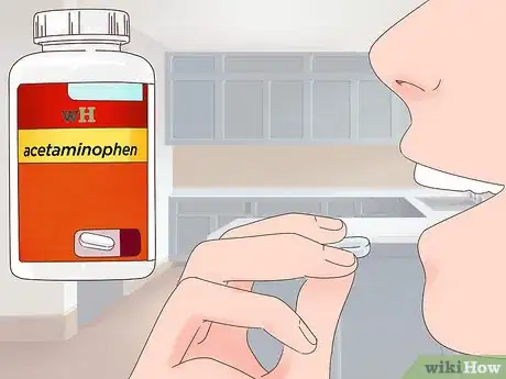 Imagen titulada Get Rid of Bruises Step 5