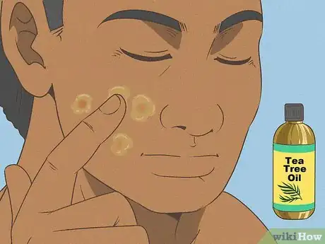 Imagen titulada Reduce Pimple Redness and Size (Aspirin Method) Step 6