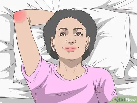 Imagen titulada Heal a Hyperextended Elbow Step 13