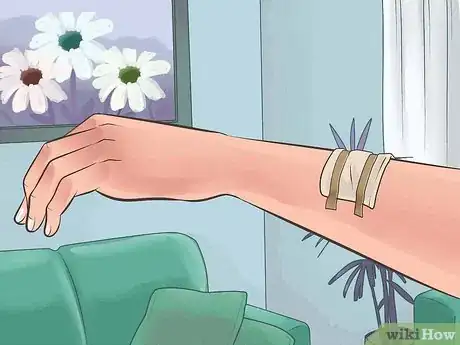 Imagen titulada Heal from a Skin Biopsy Step 3