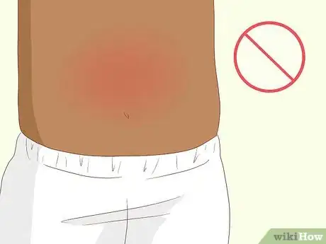 Imagen titulada Know If You Have Worms Step 6