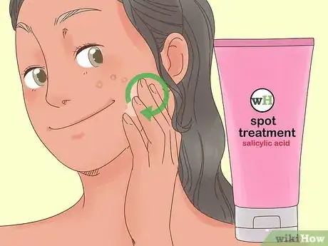 Imagen titulada Remove the Redness of a Pimple Step 8