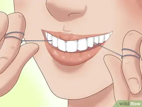 Imagen titulada Have the Perfect Smile Step 8