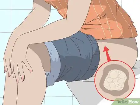 Imagen titulada Reduce Vaginal Discharge Step 14